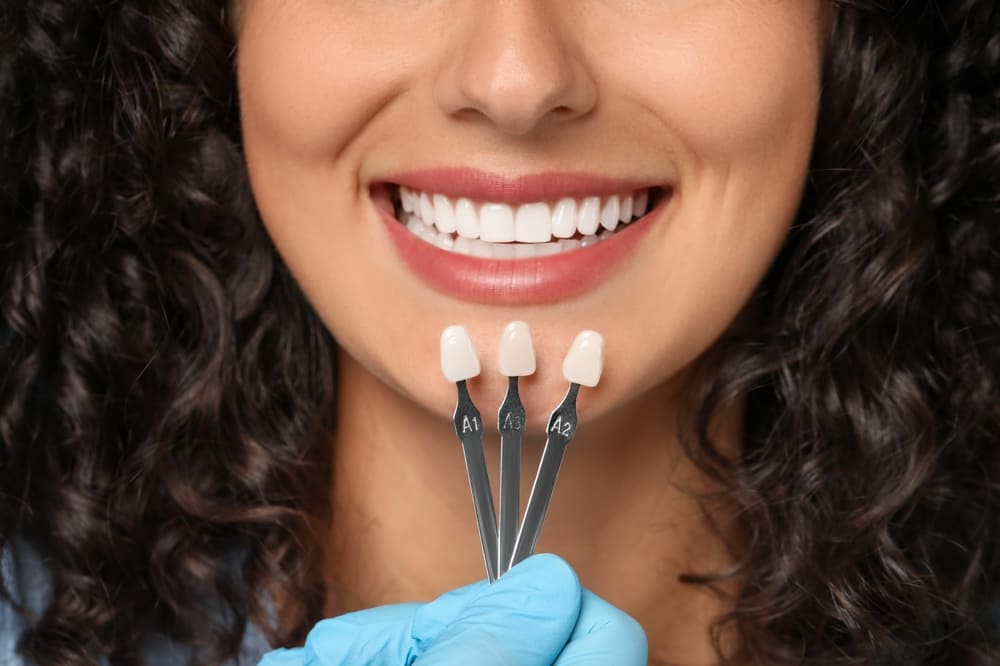 cosmesi dentale paullo