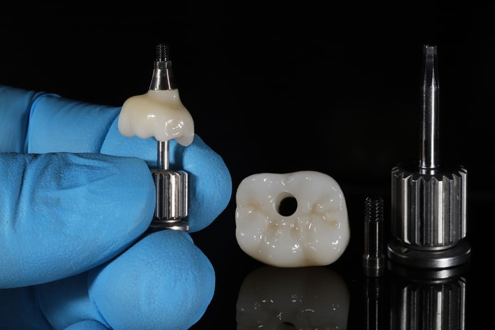 implantologia dentale paullo