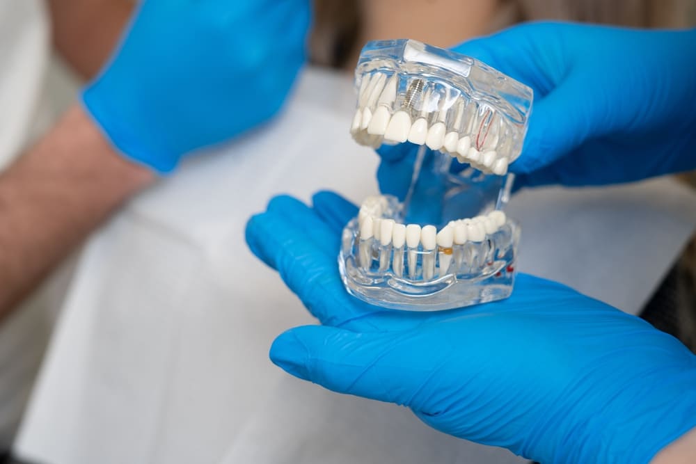 implantologia computer assistita Paullo