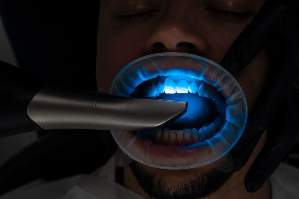 impronte dentali digitali Paullo